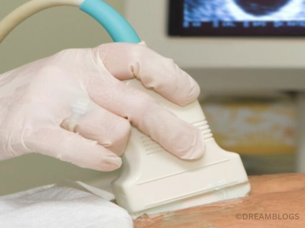 How Much Do Ultrasound Technicians Make?